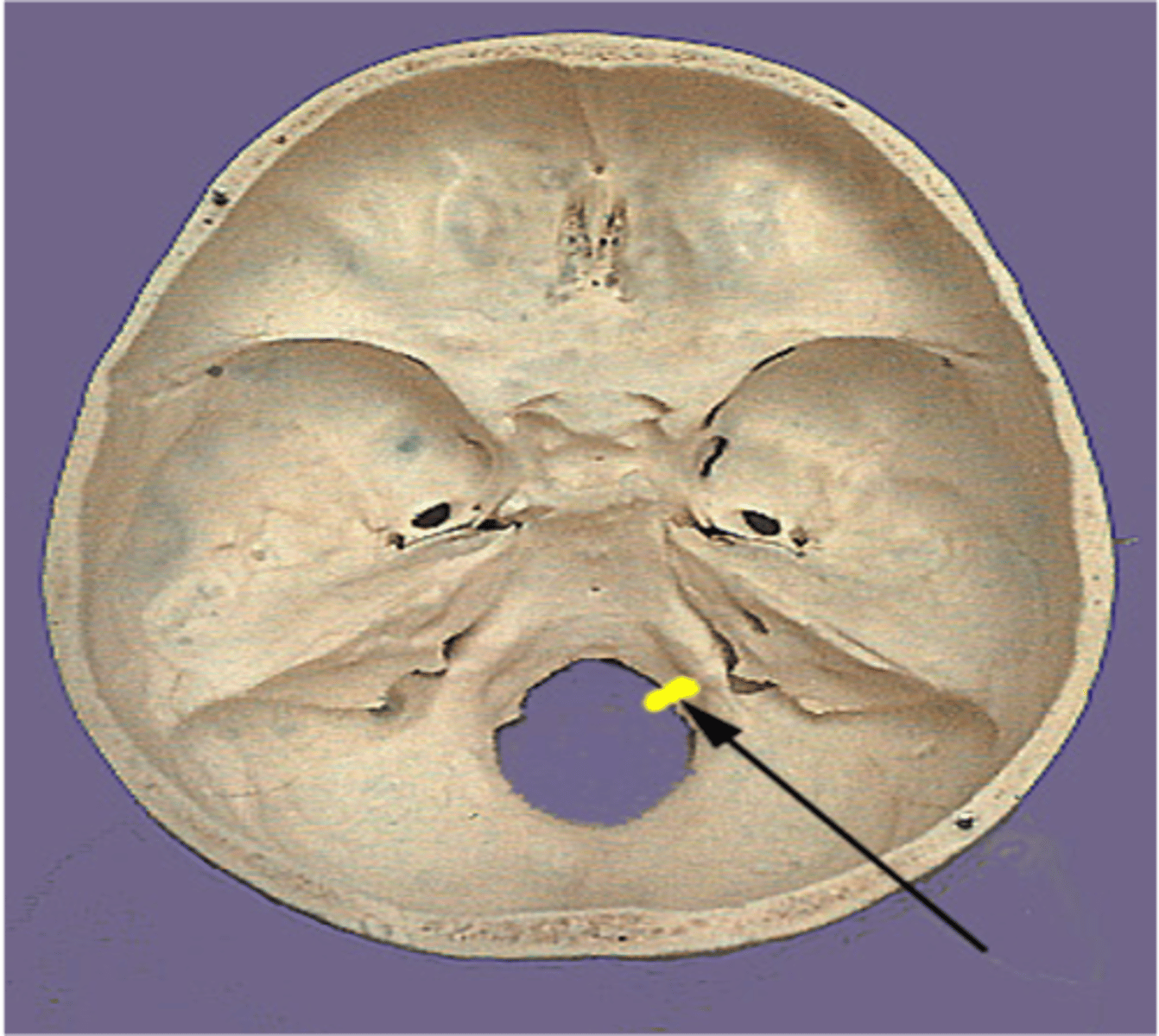 <p>Hypoglossal canal</p>