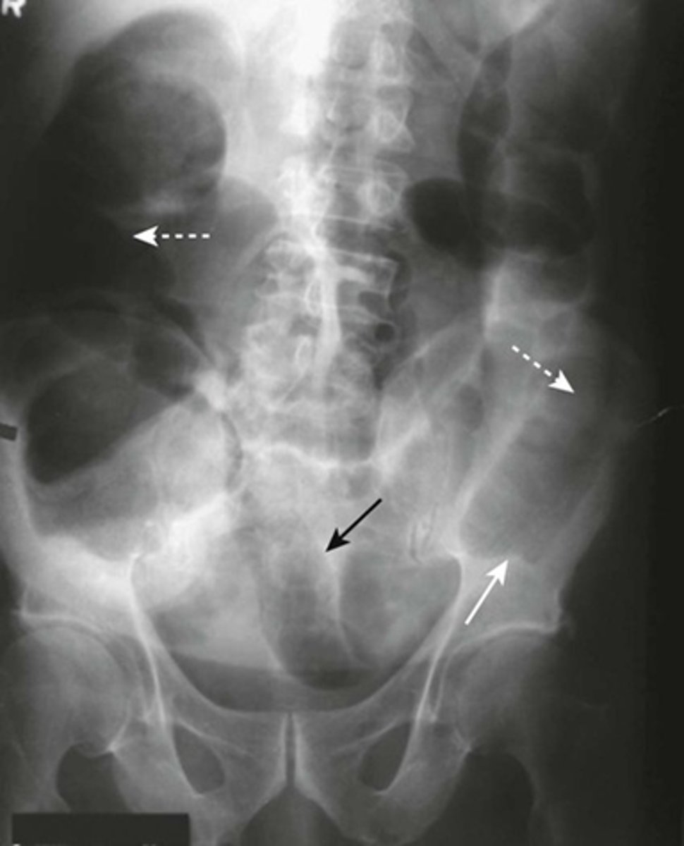 knowt flashcard image