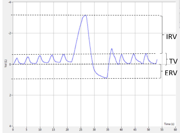 im confused… ask joanne!

Calculate VC, TLC (53kg person), FRC and IC 
