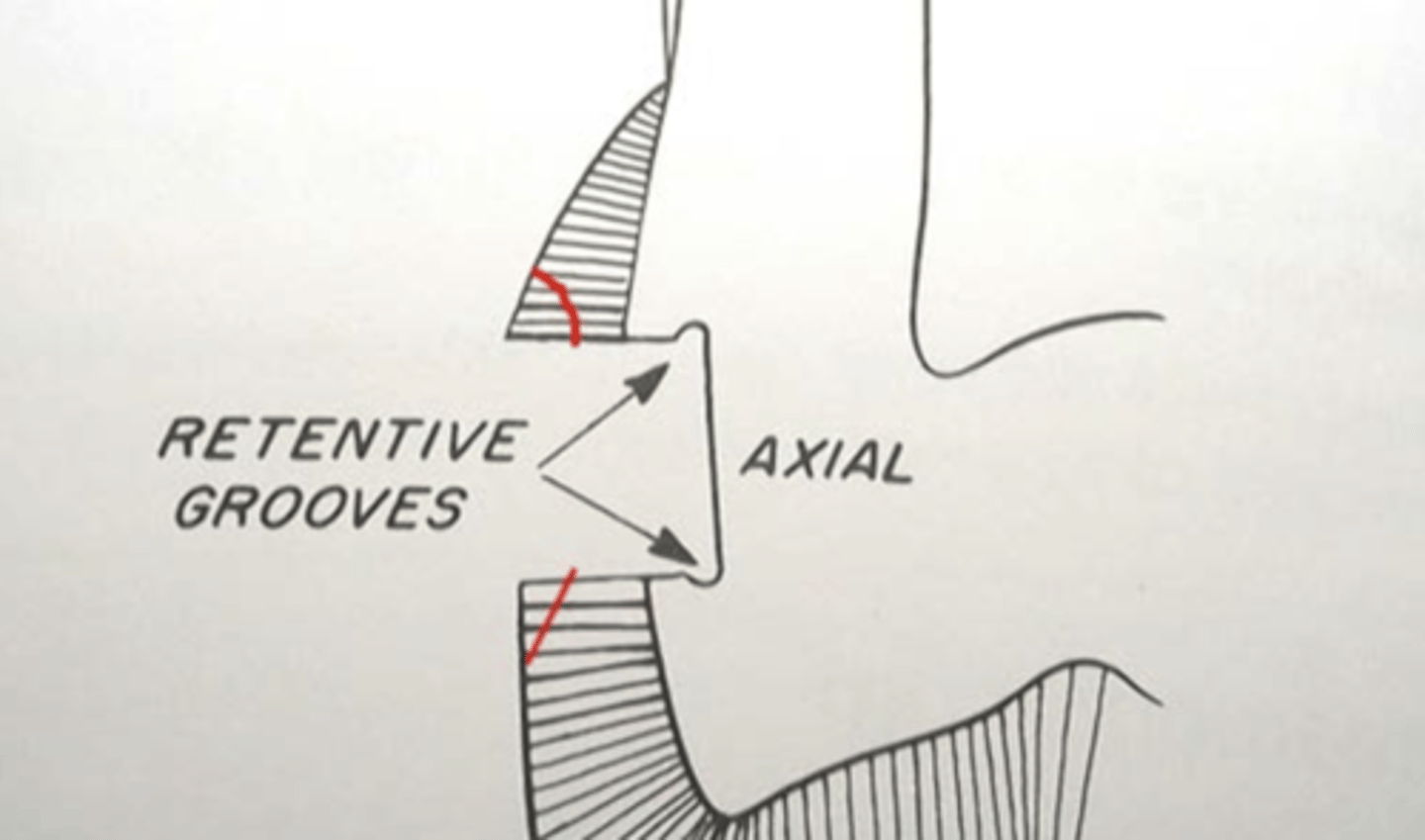 <p>secondary groove placement</p>