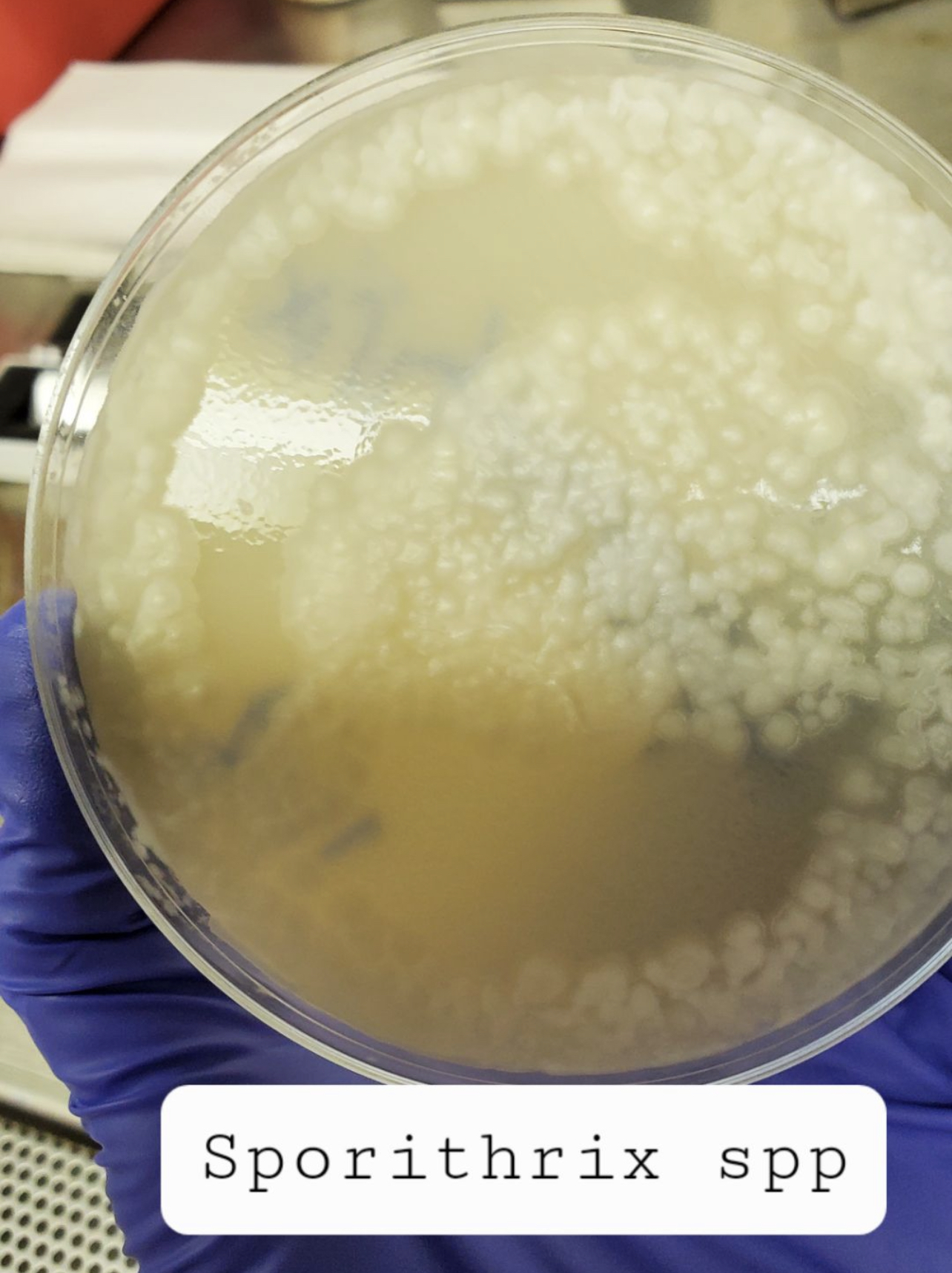 <p>Identify microscopic: Sporothrix (different growth of Sporothrix)</p>