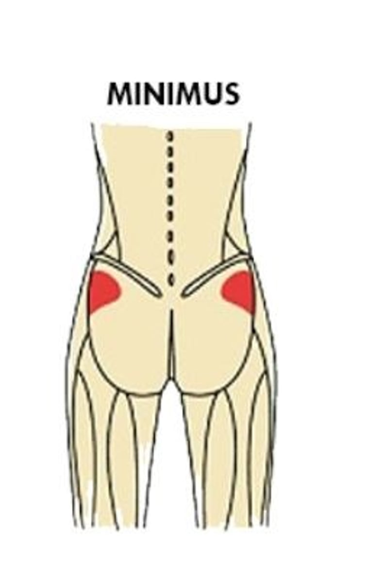 <p>Example: maximus (largest), minimus (smallest), longus (long)</p>