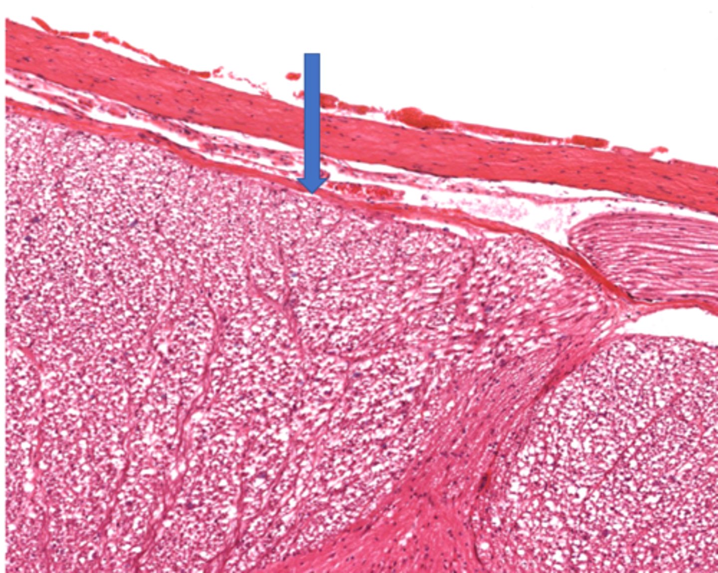 <p>Identify the part of the meninges</p>