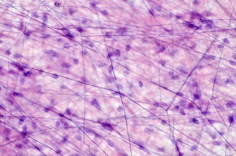 <p>Loose Connective Tissue</p>