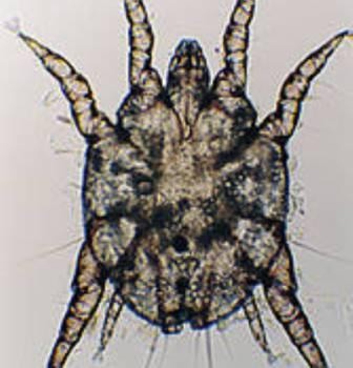 <p>Otodectes cynotis</p>