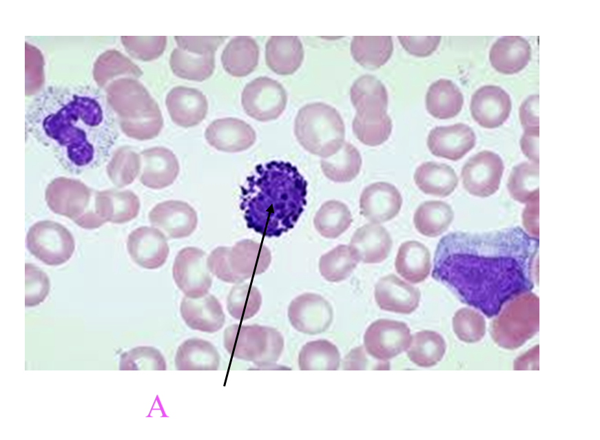 <p>What type of leukocyte is A?</p>