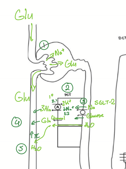 <ol><li><p>NA/K ATPase active on basolateral membrane pumps NA from cell into plasma</p></li><li><p>Na decreases in cell</p></li><li><p>Low cellular Na drives Na/Glucose linked transporter</p><ol><li><p>SGLT2: early in PCT (most)</p></li><li><p>SGLT1: late in PCT </p></li></ol></li><li><p>Na and Glucose is reabsorbed from tubular fluid into vessel</p></li><li><p>Increased oncotic pressure in vasa recta</p></li></ol><p></p>