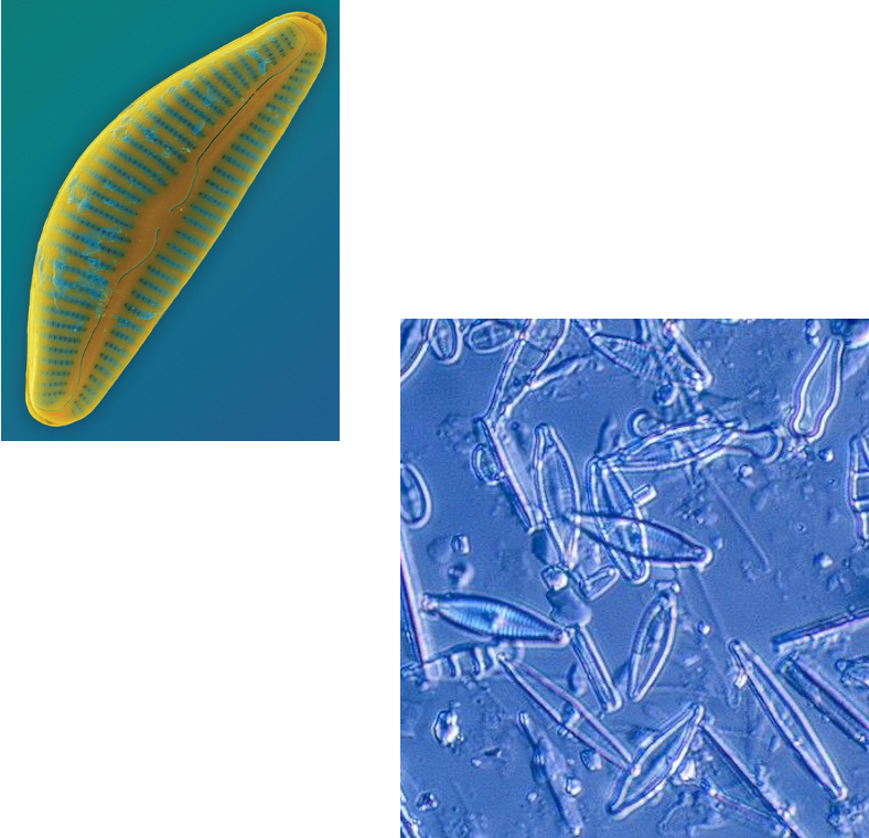<p>What member from the Chromalveolata group is this?</p><ul><li><p>Unicellular</p></li><li><p>SIlicone dioxide (glass) cell wall</p></li></ul>