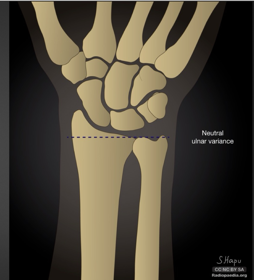 <p>what is this measurement and what is considered normal </p>