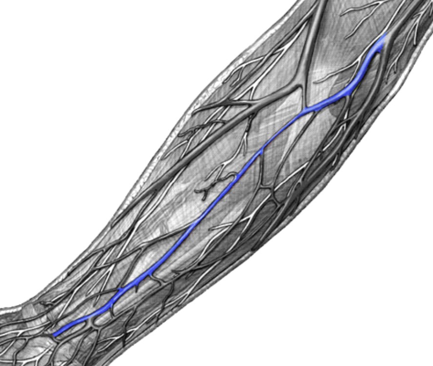 <p>Which veins:</p><ul><li><p>Branch off from basilic vein</p></li><li><p>Runs in forearm region</p></li><li><p>Medial to cephalic vein, lateral to basilic vein</p></li></ul><p></p>
