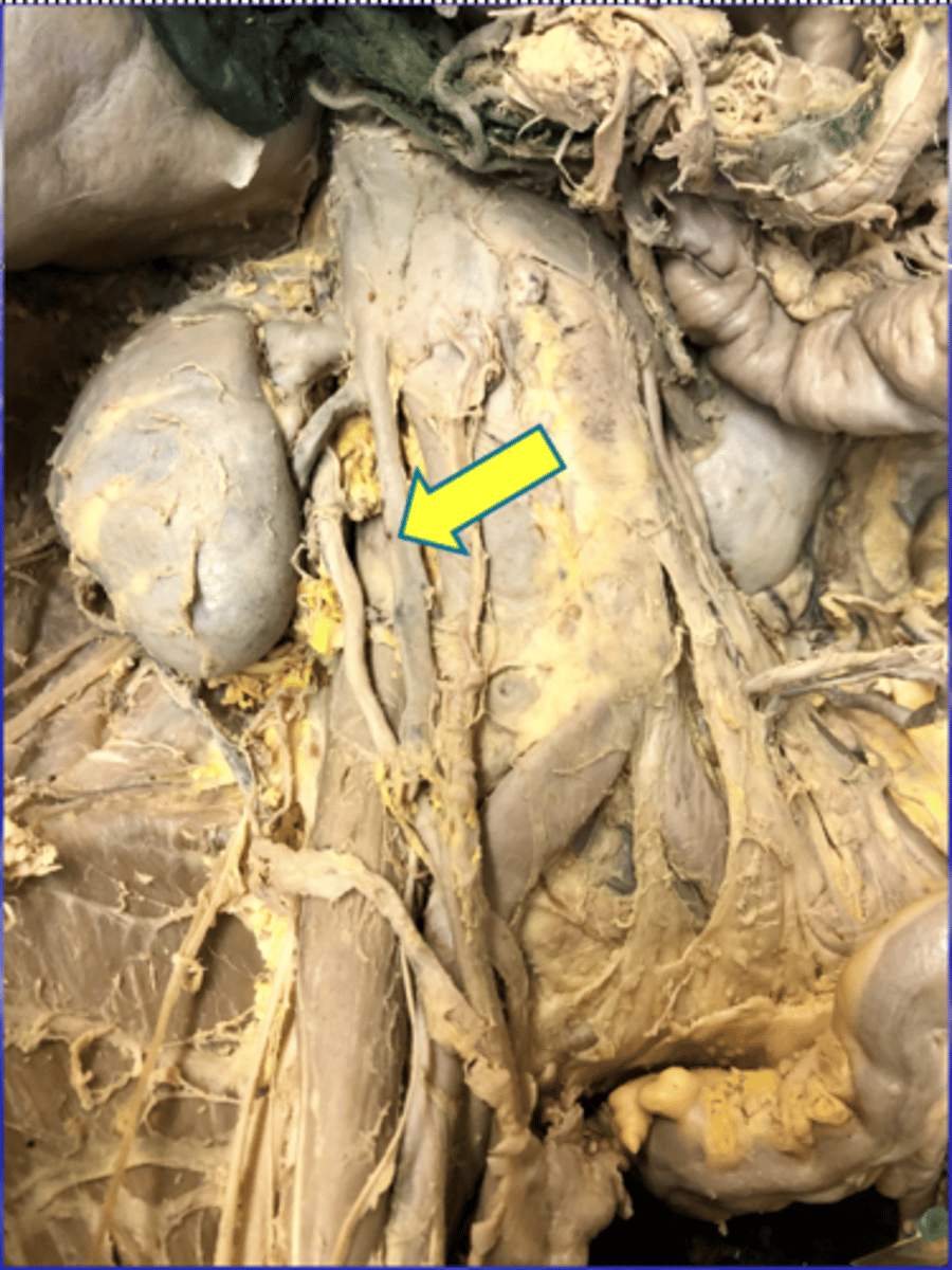 <p>ID, assume pt is male</p>