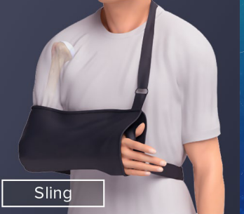 <p><strong>Proximal Humerus Fractures: Treatment and Surgical Referral</strong></p><p>-Treatment: Non-__________ or minimally displaced</p><ul><li><p>____________ (sling), ice, pain meds, and PT</p></li><li><p>_____ x-rays to monitor for displacement </p></li><li><p>Healing time is _-__ weeks </p></li></ul><p>-Surgical Referral: </p><ul><li><p>Fractures of ________ neck (risk of avascular necrosis d/t circumflex artery)</p></li><li><p>__________ or comminuted fractures</p></li><li><p>_____/vascular injury</p></li><li><p>______ fracture</p></li><li><p>Fracture-dislocations </p></li></ul><p></p>