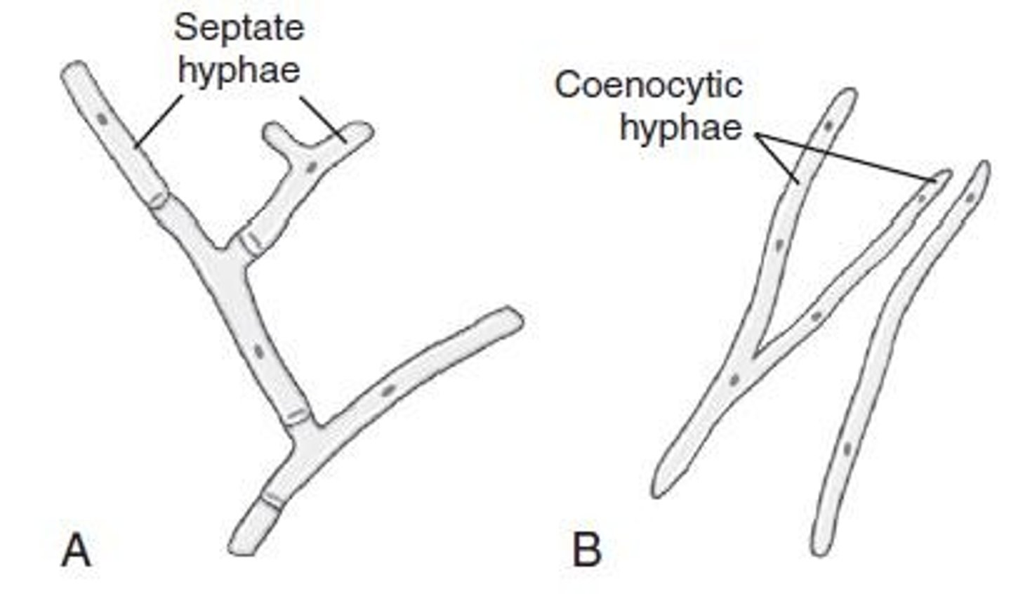 <p>Septate hyphae have cross walls, while coenocytic hyphae do not.</p>