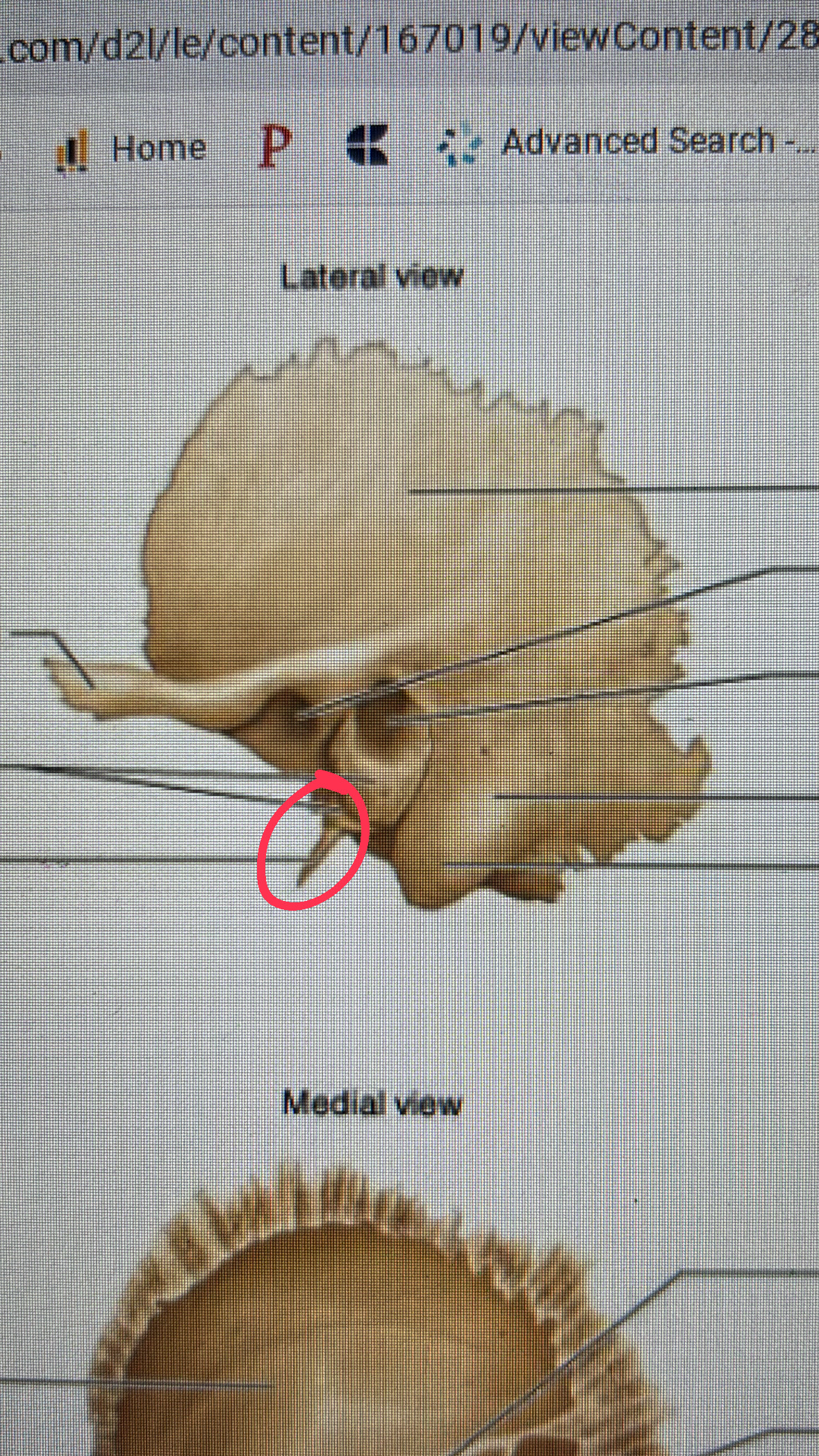 <p>sharp bone under ear canal</p>