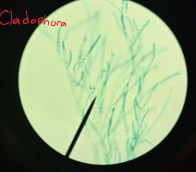 <p>What is cladophora’s body form and environment?</p>