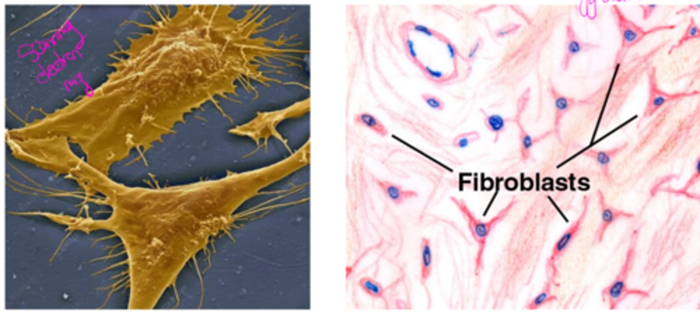 <p>Fibroblastic and Mesenchymal cells; they secrete extracellular matrix proteins.</p><p>They are fried egg or spindle shaped, characterized by extensive ROUGH ER.</p>