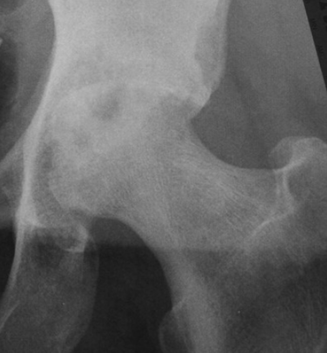 <p>What pathology is this?</p>