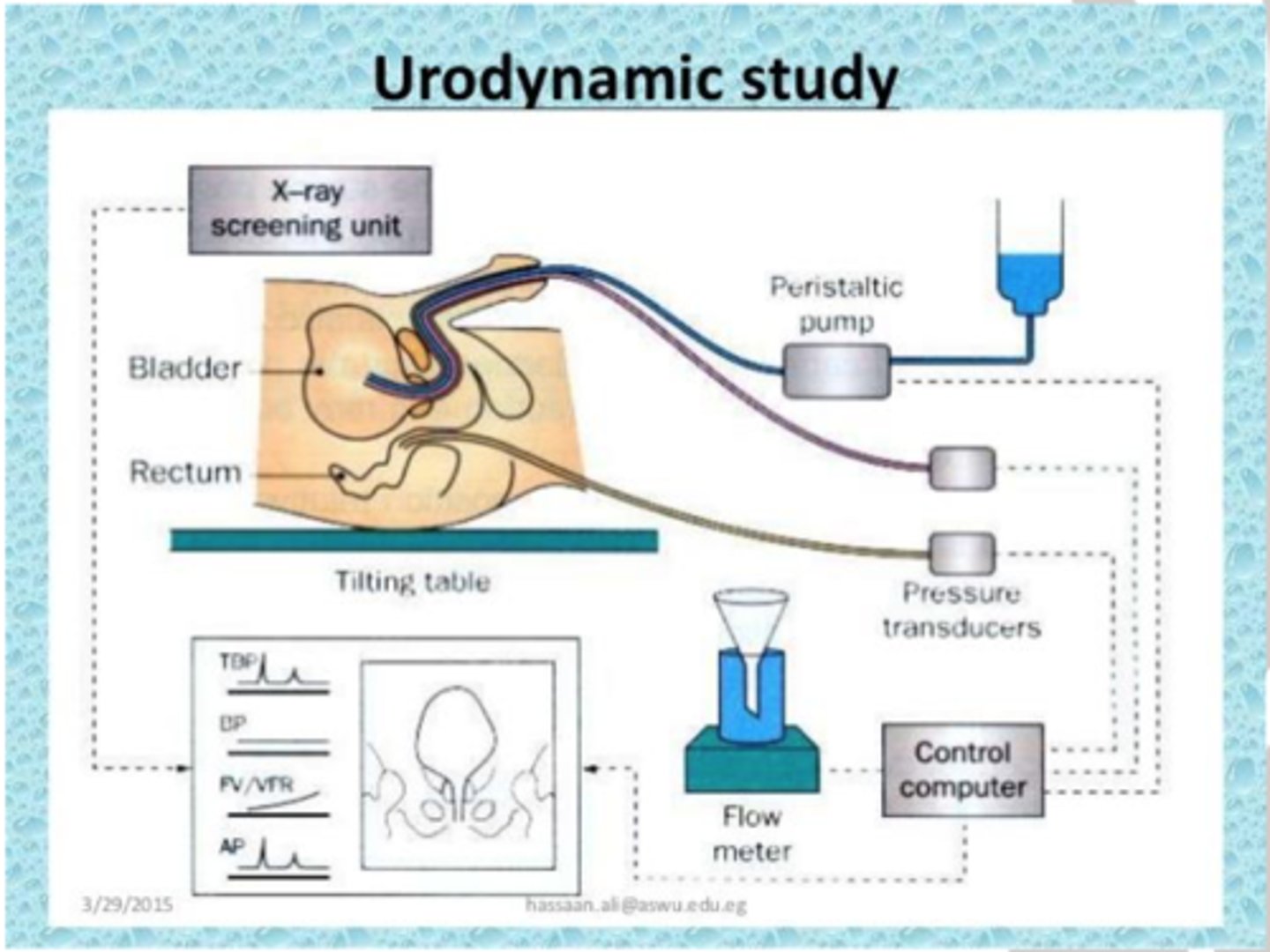 <p>diagnostic study of urine storage, bladder pressure, and urine flow throughout the urinary tract</p>