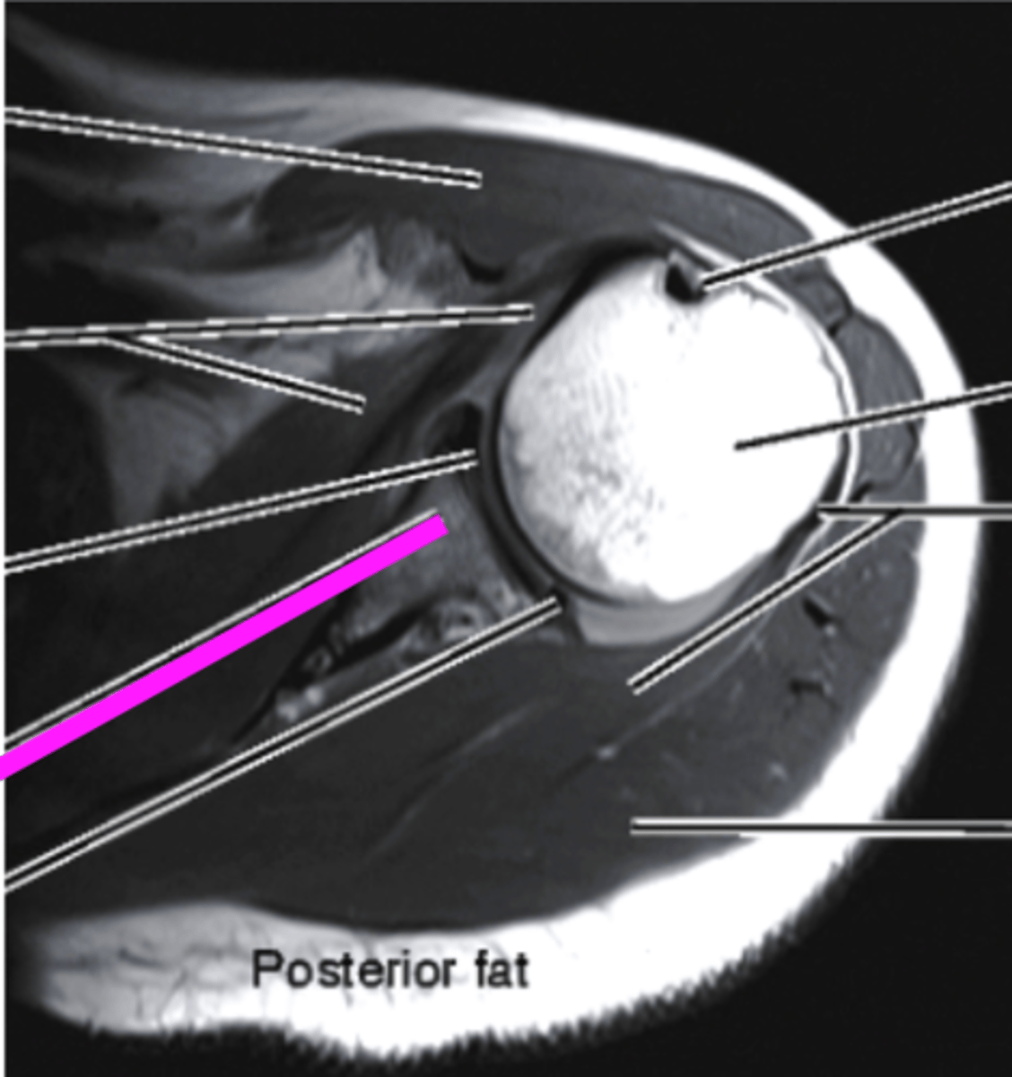 <p>what does the pink line point to?</p>