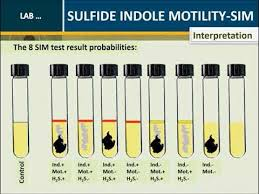 <ul><li><p>sulfide production, indole, motility</p></li><li><p>complex</p></li><li><p>differential</p></li><li><p>ferrous ammonium sulfate</p></li><li><p>cytseine desulfhydrase enzume breaks down cysteine into sulfide or create during anaerobic respiration</p></li><li><p>pos: black color; Proteus vulgaris</p></li><li><p>neg: no black color; Enterococcus faecalis but motile, Enterobacter aerogenes not motile</p></li></ul><p></p>