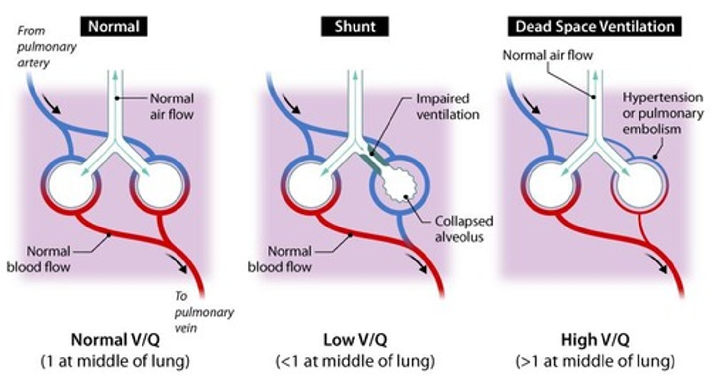 <p>Volume of air in non-exchanging alveoli.</p>