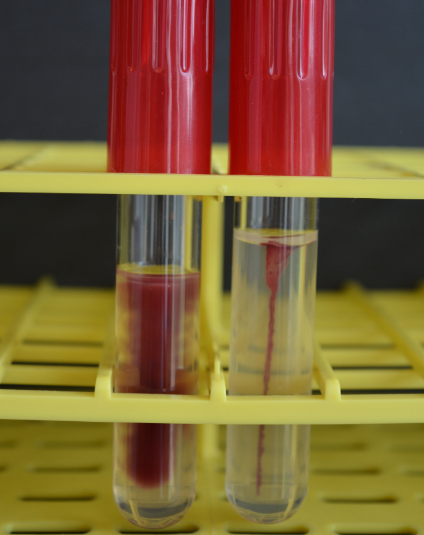 <p>Name this test</p><p>Which side is positive</p><p>Name the bacteria</p><p>What percent is agar</p>