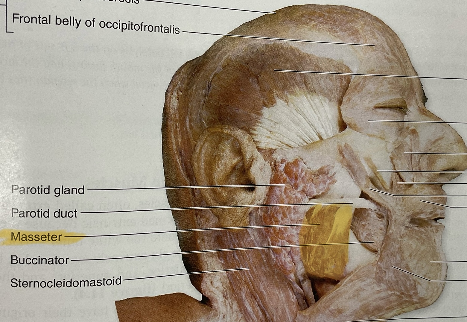 <p>Elevate, protract mandible</p>
