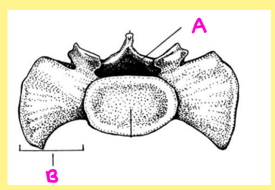 <p><u>Name the following</u>:</p><ul><li><p>Bone?</p></li><li><p>Side?</p></li><li><p>View?</p></li><li><p>Specific Surface? (if applicable)</p></li><li><p>A?</p></li></ul><p></p>