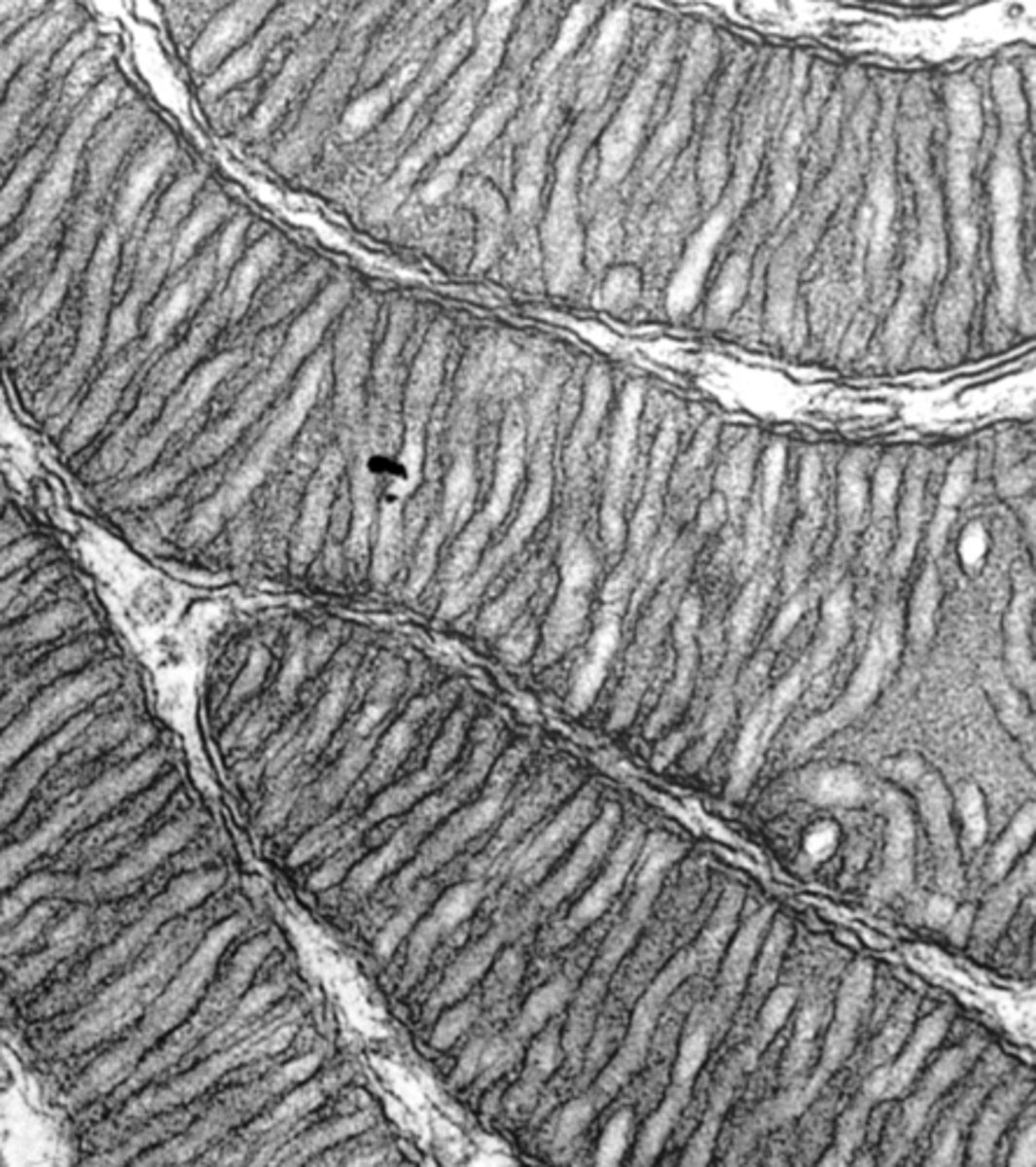 <p>what organelle structure is shown within these mitochondria?</p>