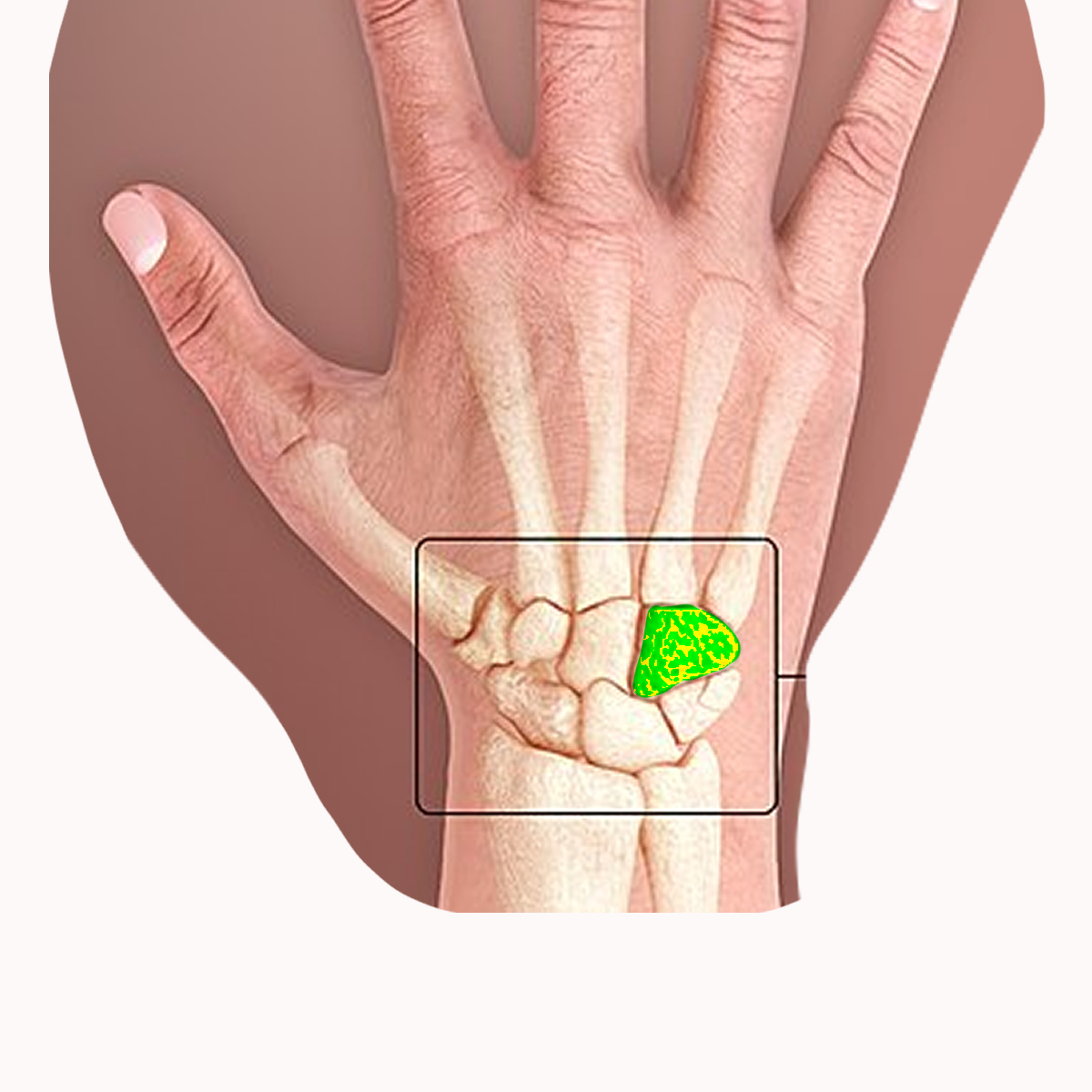 <p>Name the highlighted carpal</p>