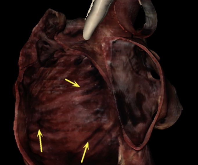 <p>What are the yellow arrows pointing to?</p>