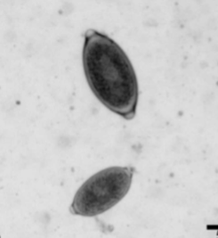 <p>adults are located in bronchi and trachea&nbsp;</p>