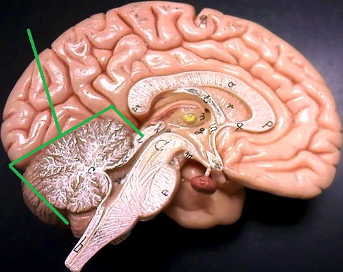 a major feature of the hindbrain responsible for body movements and balance