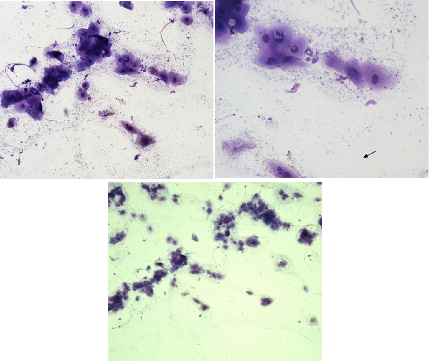 <p>Fall 4 - Osäkert löpningsdygn. Ägaren har flera tikar, svårt att veta vem som löper. Tror att Heidrun höglöper.<br><br>Cellbild? Cykelstadie?</p>