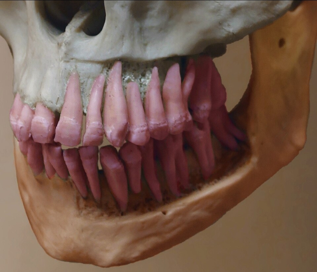 <p>What type of bone marking is this?</p>