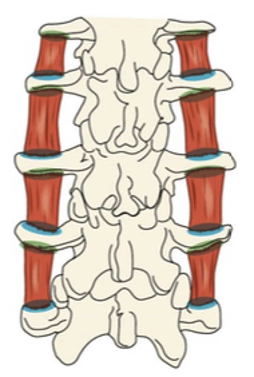<p>What muscle is this?</p>