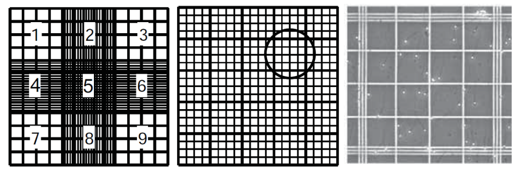<p><span>Using improved Neubauer haemocytometer </span></p><p style="text-align: left"><span>Counting at least 400 sperms</span></p><p style="text-align: left"><span>&lt; 15 x 10<sup>6 </sup>/ mL Oligospermia - fewer cells than normal </span></p>