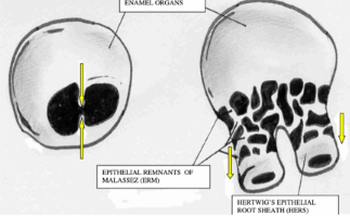 <p>-start of root formation coincides with start of eruptive movement of the tooth</p><p>-subdivision accomplished by horizontal outgrowth of 2 or 3 epithelial flaps across the cervical opening- first visible in late cap or early bell stages</p><p>-usually consist of IEE and OEE, resembling histologic structure of HERS- flaps fuse once they meet in the center of the cervical opening</p>