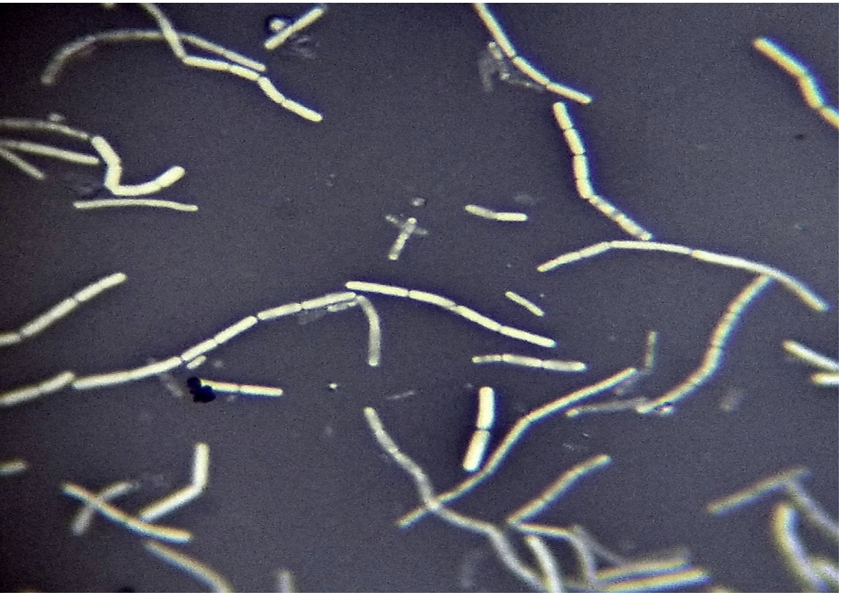 Bacillus cereus (negative stain)