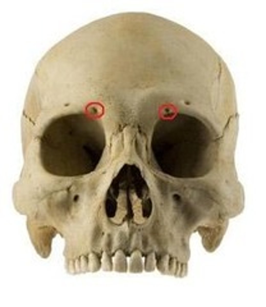<p>opening above each orbit allowing blood vessels and nerves to pass</p>