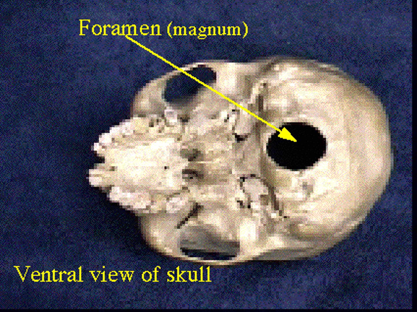 <p>Name the bone depression: </p>