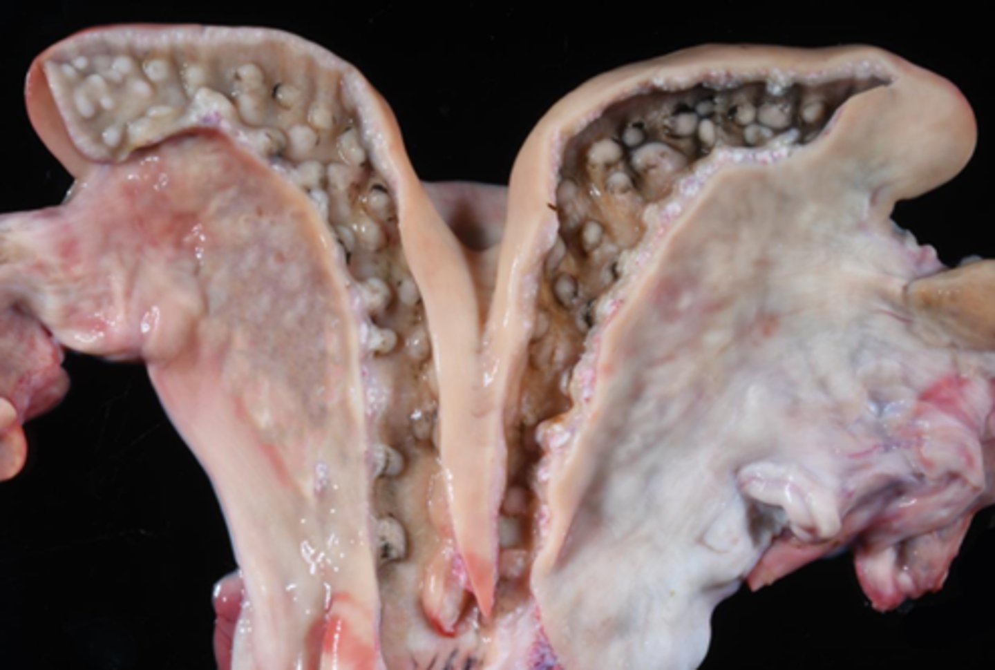 <p>sites of placental attachement, whose primary function is to fuse with fetal cotyledons to form placentones</p>