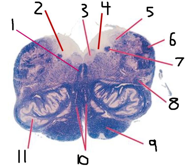 <p>(4) #5 is the:</p>
