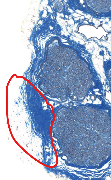 <p>(layer)</p>