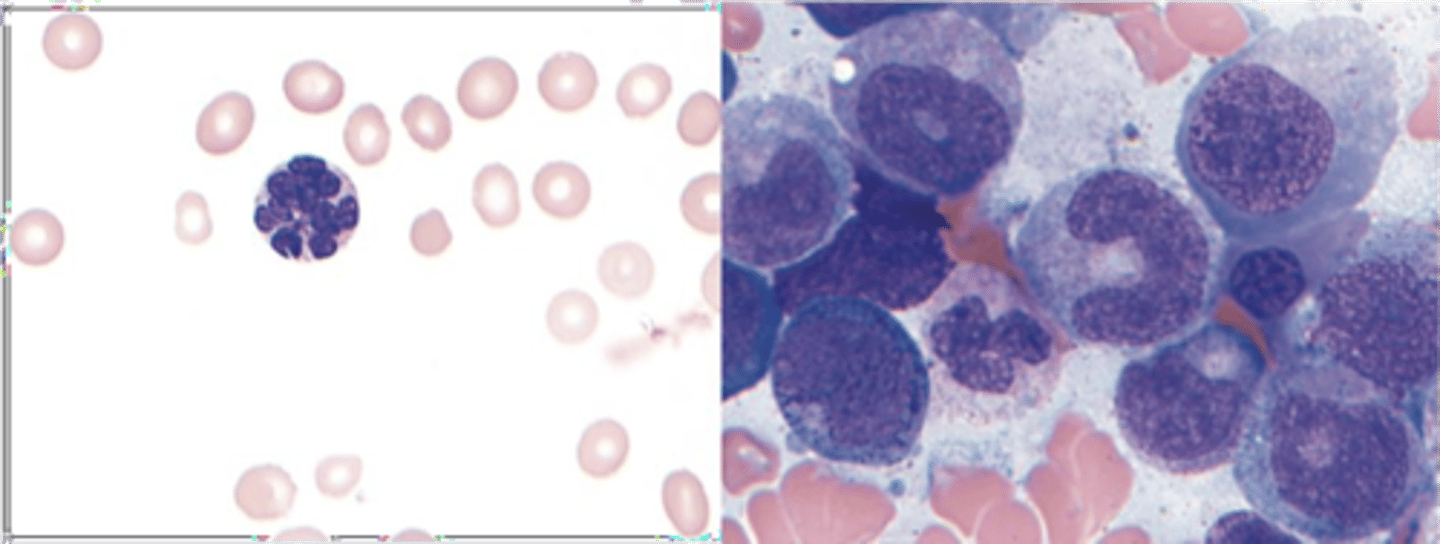 <p>Hypersegmentation of a neutrophil and abnormally large erythroid precursor cells are associated with a deficiency in what vitamin?</p>