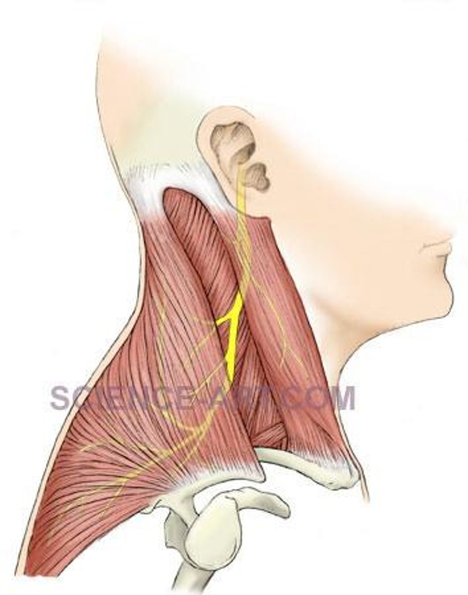 <p>spinal accessory nerve</p>