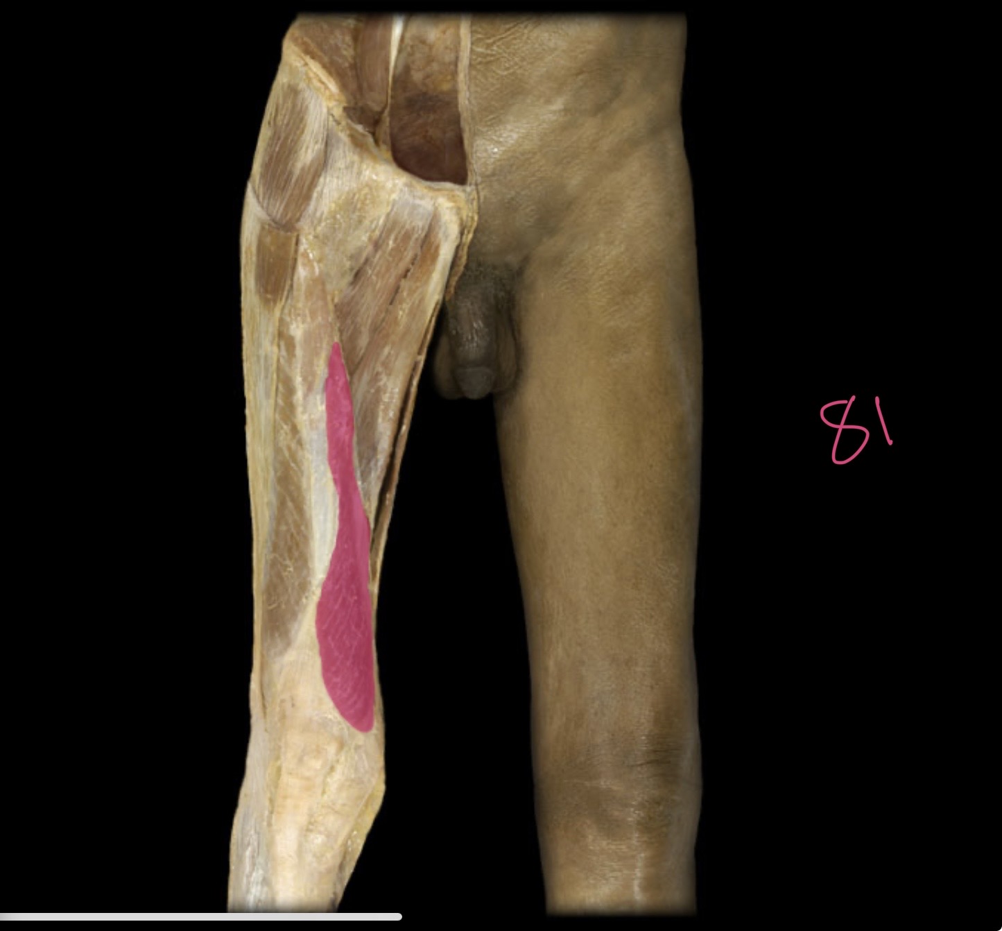 <p>Vastus medialis</p>