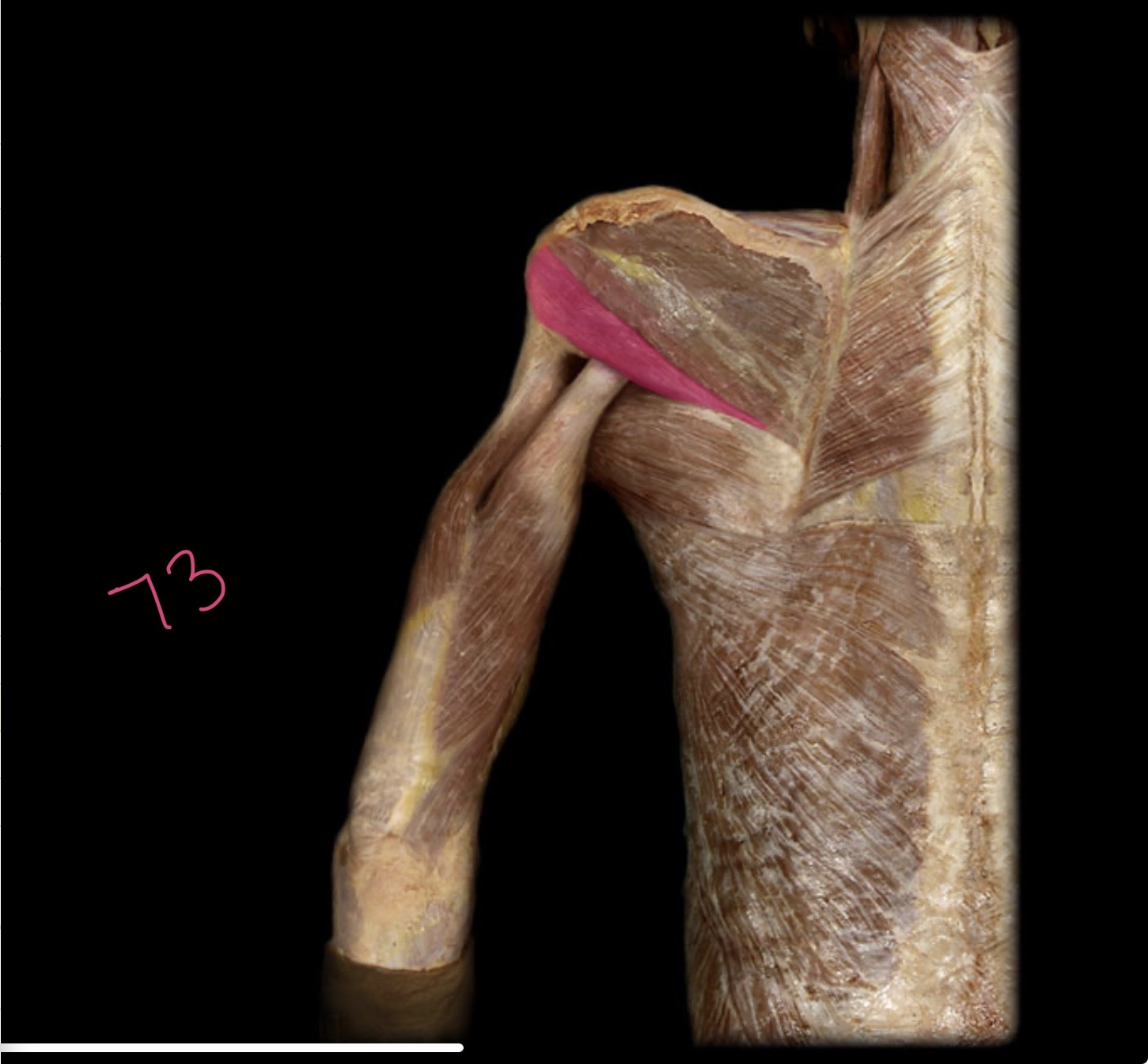 <p>Teres minor </p>