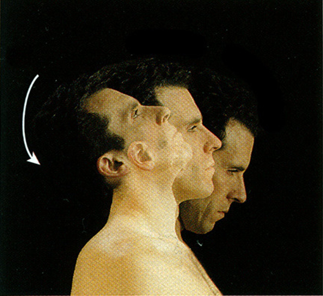 <p>extension that is greater than 180 deg</p>