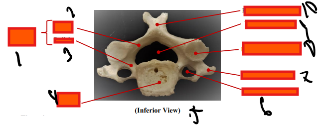 <p>inferior&nbsp;</p>